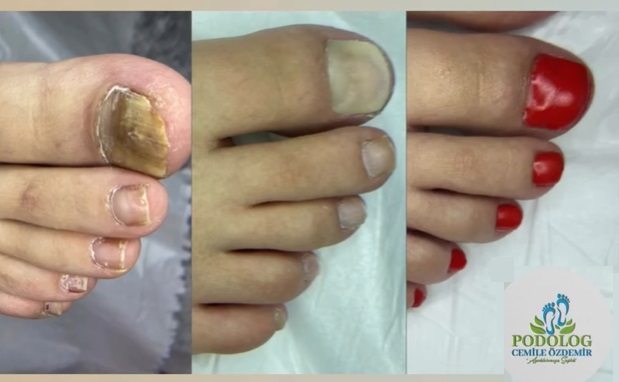 Ankara Ayak Sağlığı Merkezi